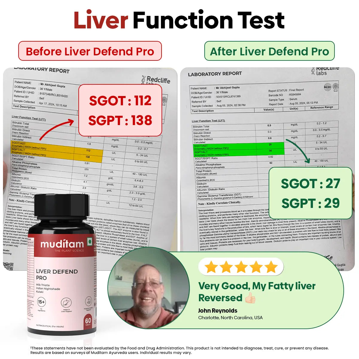 Liver Defend Pro